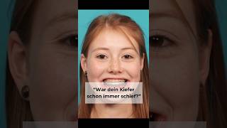 „War dein Kiefer schon immer schief“ bimax kiefer bimaxop kieferop kieferoperation Dysgnathie [upl. by Atinuahs994]