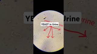 Urine analysisshortvideoshotslike dailyshortstrendinglaboratorylifemedicallaboratorystudents [upl. by Meras]