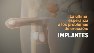 La última esperanza a los problemas de erección Implantes [upl. by Grosvenor628]