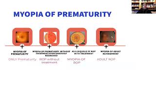 Lecture Myopia in Children Treated for Retinopathy of Prematurity [upl. by Erelia330]