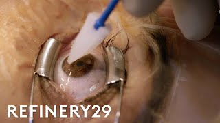 What Getting Laser Eye Surgery Is Really Like  Macro Beauty  Refinery29 [upl. by Bellis]