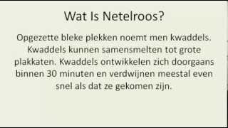 Netelroos  Wat Is Netelroos En Hoe Bestrijdt Je Het [upl. by Hafital]