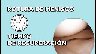 Tiempos de recuperación tras una rotura de MENISCO [upl. by Asital883]