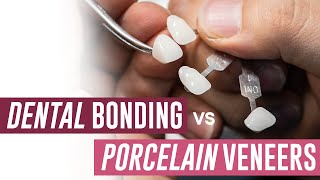 Dental Bonding vs Porcelain Veneers  Which Should I Get [upl. by Gazzo715]