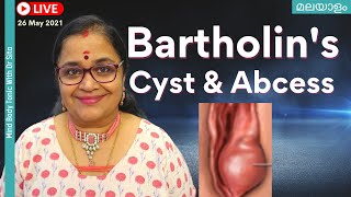 Bartholin Cyst  മലയാളം  Abscess  Symptoms amp Treatment  Marsupalisation   Dr Sita [upl. by Akirahc]