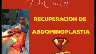 Recuperación de Abdominoplastia  Dr Cortes [upl. by Jerry]