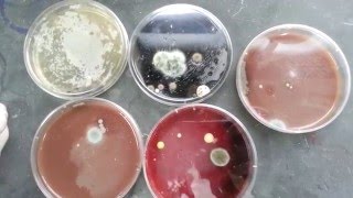 Fungal contaminated various culture plates [upl. by Abdella213]