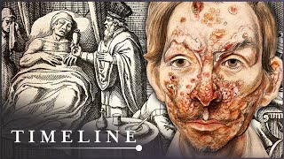 The True Terrors Of Tudor Medicine  Hidden Killers  Timeline [upl. by Oliric]