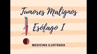 Tumores Malignos Esófago 1 [upl. by Alinna]