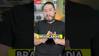 Causas comunes de bradicardia asintomática 🫀 emergency [upl. by Adnaram]