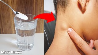 Home Remedies for Swollen Lymph Nodes [upl. by Nnawtna]