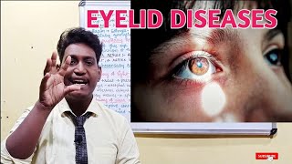 diseases of eyelids entropion and ectropion eyelid diseases 2021 [upl. by Efinnej]