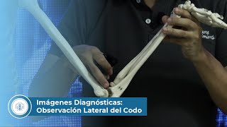 Imágenes Diagnósticas Observación Lateral del Codo [upl. by Victor]