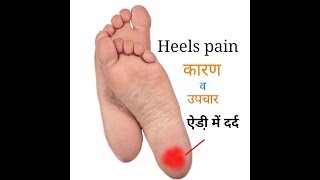 heel pain treatment  ऐडी़ में दर्द कारण एवं उपचार  heels painHindi [upl. by Malan884]