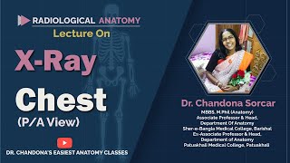 Lecture On Xray chest PA view [upl. by Ecitnirp]