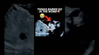 Things babies do in the womb ultrasound pregnancy baby cutebaby womenshealth [upl. by Bierman]