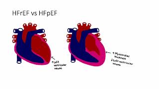 Congestive Heart Failure [upl. by Matelda]