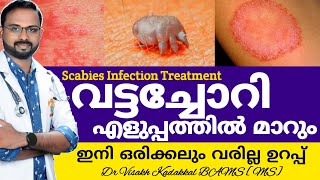 വട്ടച്ചോറി മാറാൻ  Vattachori Maran  Scabies infection CausesSymptomsTreatment  DrVisakhKadakkal [upl. by Anuala]