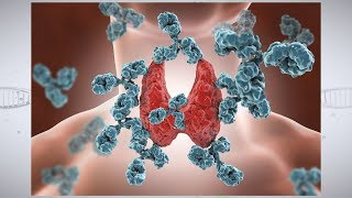 Understanding Autoimmune Thyroid Disease [upl. by Cyrus]