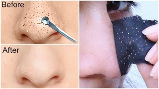 Easy DIY BLACKHEAD Remover Peel Off Mask  INSTANT RESULTS  Anaysa [upl. by Anytsirhc]