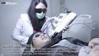 Laser Nano Peel [upl. by Amer397]