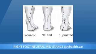 Foot Pronation And Supination  What Is The Difference [upl. by Giarc]