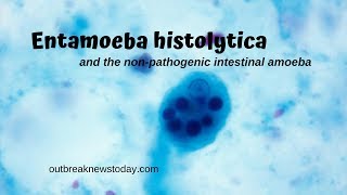 Entamoeba histolytica and the nonpathogenic intestinal amoeba [upl. by Dolhenty]