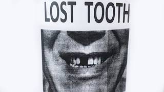 Lost Tooth  Please email if found [upl. by Aerol]