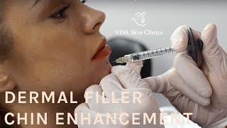 Dermal Filler Chin Enhancement  Dr Rupert Critchley VIVA Skin Clinics [upl. by Zahc]