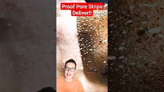 PROOF PORE STRIPS WORK  Phenomenal Pore Strip Removal shorts [upl. by Nodnal]