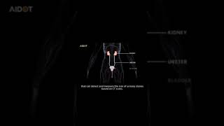 URO dot AI AI based urinary stone detection system [upl. by Medardas]