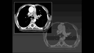 Cardiac CT in Pediatircs Part 1 [upl. by Ynoble]