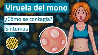 VIRUELA del mono SÍNTOMAS y formas de contagio [upl. by Seek]