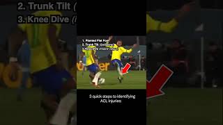 Neymar STRETCHERED off with Torn ACL  Doctor Explains [upl. by Anitram361]