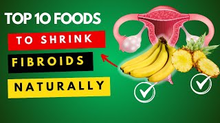 Top 10 foods to shrink fibroids naturally and fast [upl. by Uol]