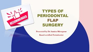 Periodontal Flap Surgery for Periodontitis [upl. by Timotheus]