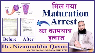 Dr Nizamuddin Qasmis Miracle Treatment for Azoospermia amp maturation arrest  LifeChanging Results [upl. by Nihsfa133]