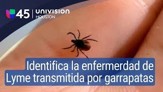 Aprende a identificar los síntomas de la enfermedad de Lyme transmitida por las garrapatas [upl. by Nner]