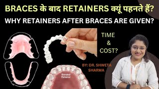 Retainers After Braces in Hindi Cost Time Why Retainers Are Important [upl. by Anidam696]