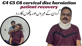 C4C5C6 Cervical Disc Herniation Quick Patient recovery physioshubb [upl. by Airyt]