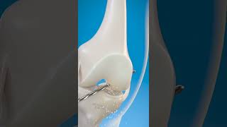 How doctor treat the ligament problem shorts goodscience [upl. by Ailak]