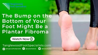 The Bump on the Bottom of Your Foot Might Be a Plantar Fibroma [upl. by Chesnut115]