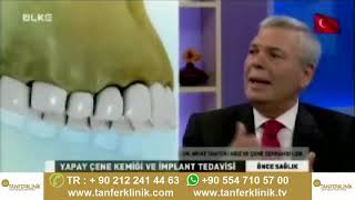 implant nedir  Çene Kemiği erimesinde implant yapılır mi TanferKlinik [upl. by Lehte]