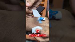 Iv cannulation  cannula doctor baby ivcannulation SMpharmacy subscribe [upl. by Oetam]