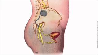 Fecal Incontinence  Heidi Chua MD  Mayo Clinic [upl. by Artenak]