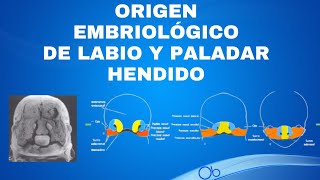 Origen Embriológico de Labio y Paladar Hendido [upl. by Adnohsirk937]