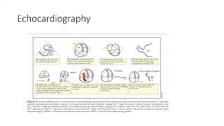 Pulmonary Embolism [upl. by Hctud876]