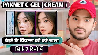 Paknet c gel uses dose benefits and Side effects full review in hindi [upl. by Reiser]