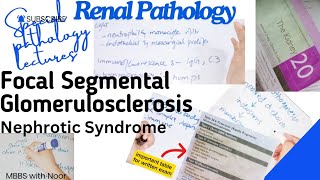 focal segmental glomerulosclerosis  nephrotic syndrome  renal pathology  selflessmedicose [upl. by Alin]