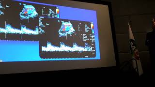 ECOGRAFÍA DOPPLER DE ARTERIAS RENALES [upl. by Noside]